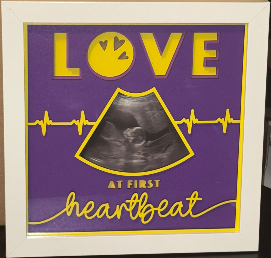 Love at First Heartbeat” Wooden Shadow Box – Custom Ultrasound Keepsake